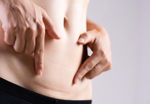 Sinh mổ có đau không? Mổ bao lâu thì hết đau? Giải đáp để mẹ yên tâm trước khi sinh