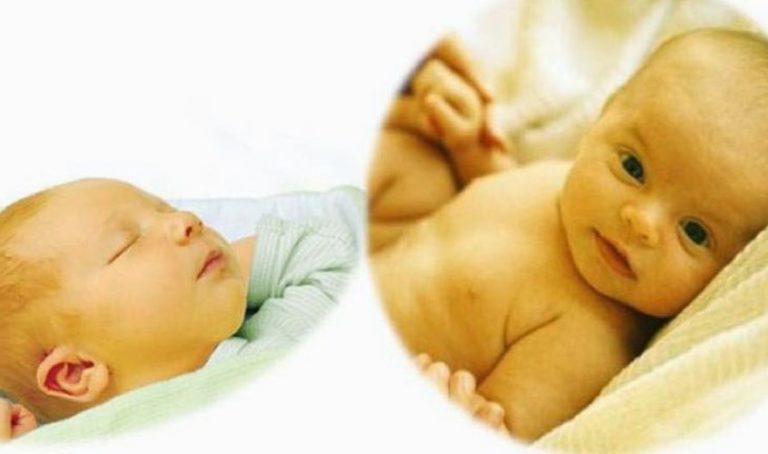 Vàng da sinh lý & vàng da bệnh lý ở trẻ sơ sinh