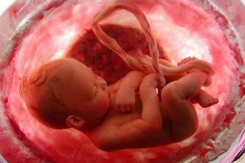 đa ối có nguy hiểm với thai nhi không