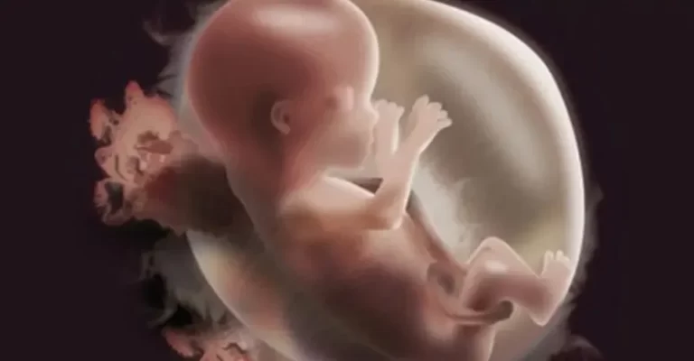 Đa ối là gì? Có nguy hiểm không và mẹ bầu cần làm gì để an toàn?