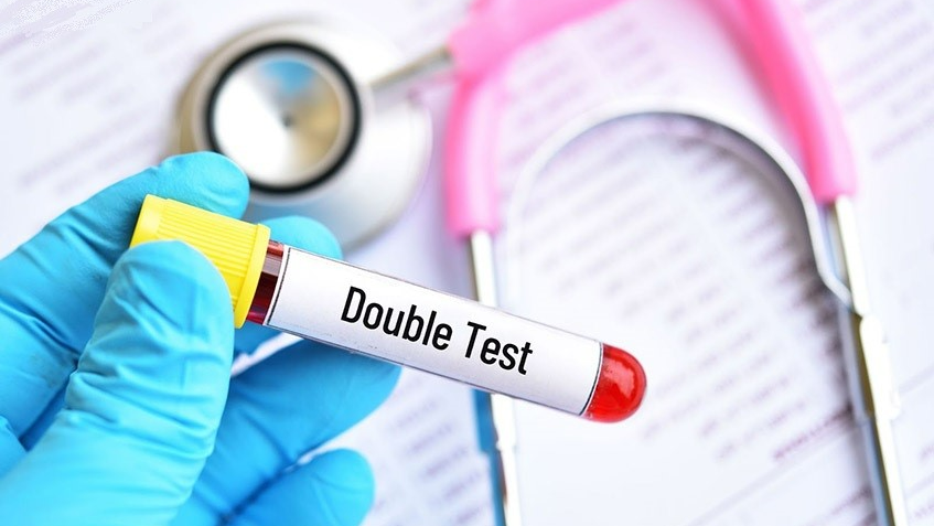 double test kiểm tra dị tật thai nhi
