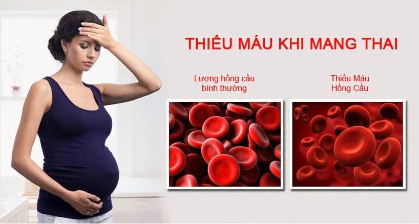 mẹ bầu thiếu máu do thiếu sắt